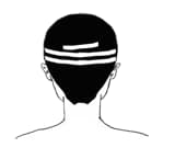TYPE-Cのヘアタトゥー範囲図（植毛傷跡）