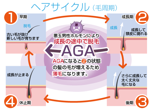 ヘアサイクル（毛周期）のイラスト