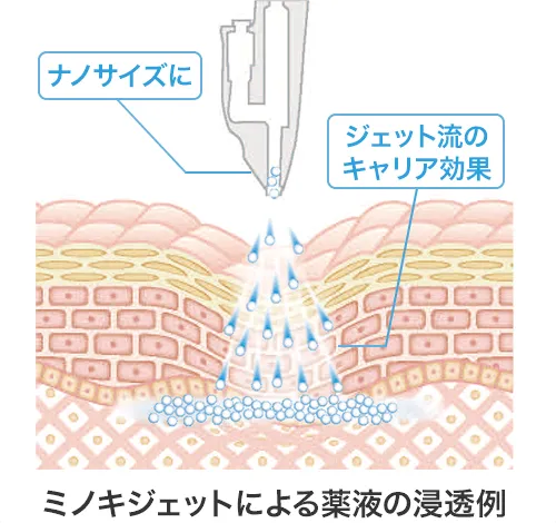 ミノキジェットの特徴