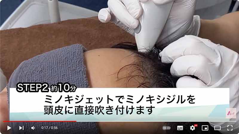 STEP2：ミノキシジルを頭皮に噴霧