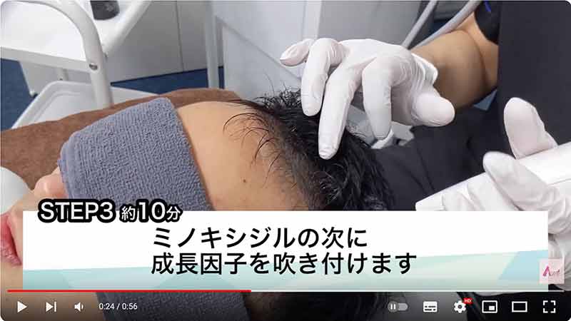 STEP3:成長因子を頭皮に噴霧