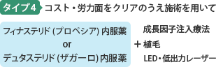 タイプ4 コスト・労力面をクリアのうえ施術を用いて  フィナステリド(プロペシア)内服薬orデュタステリド(ザガーロ)内服薬　+　成長因子 植毛 LED・低出力レーザー