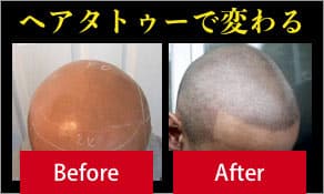 ヘアタトゥーで変わる