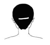 TYPE-Aのヘアタトゥー範囲図（植毛傷跡）